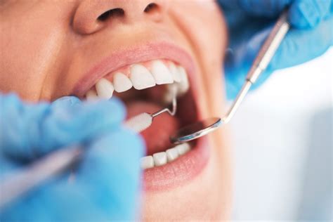 Medicaid: 5M New Yorkers to receive better dental coverage
